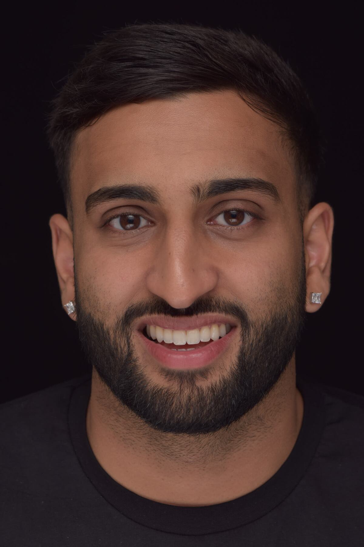Dr Cameron Bagry, cosmetic and restorative dentist in Telford