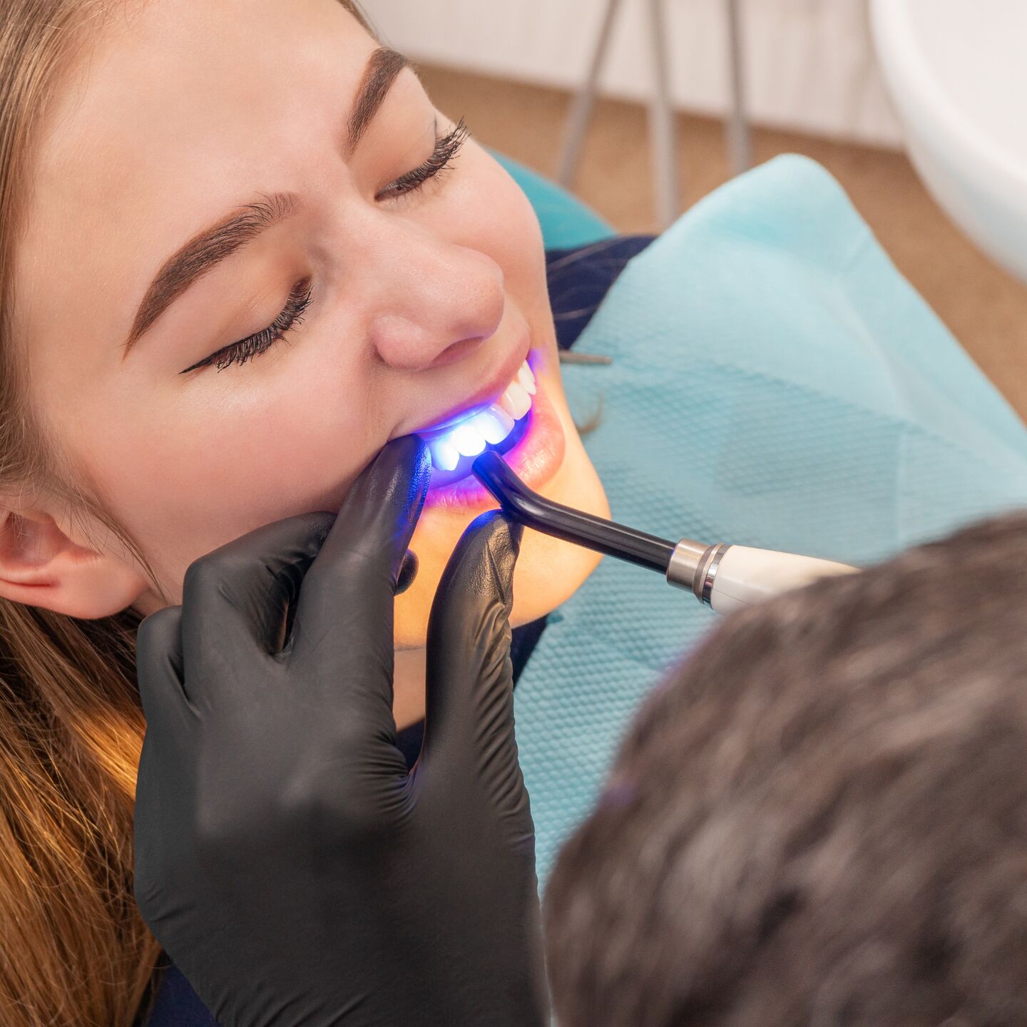 A dentist using a blue curing light on a patient&rsquo;s teeth